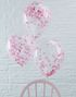 5 stk. 30 cm - Gennemsigtige Balloner med Pink Konfetti - Bland og Miks